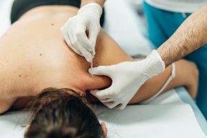 Muvia servicio fisioterapia puncion seca